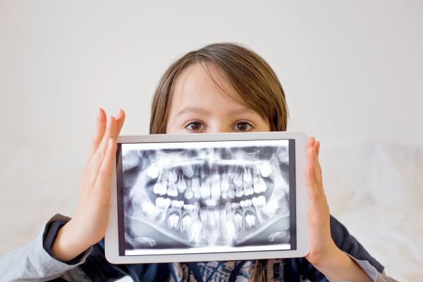 Ask A Kid Friendly Dentist: Minimizing The Dental Effects Of Thumb Sucking